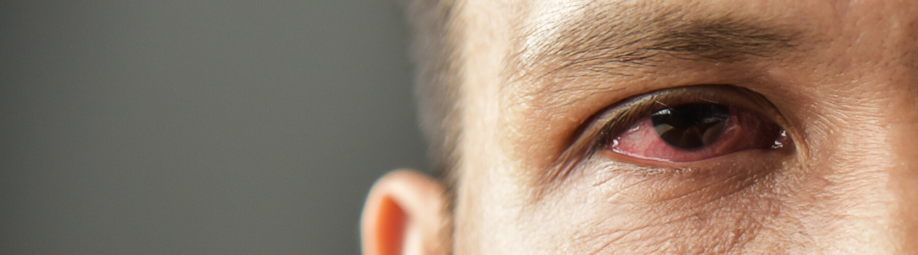 Close Up of irritated red bloodshot eye, dry eyes of a male, dark grey background