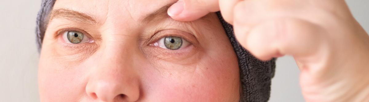 mature woman with droopy eyelid, holding her eyelid up with one finger, eye lift concept